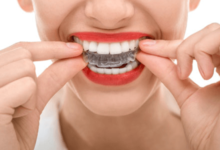 Teeth Whitening in Maple Ridge