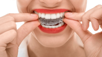 Teeth Whitening in Maple Ridge