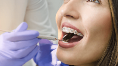 Dental Care Tips During Orthodontic Treatment in San Francisco