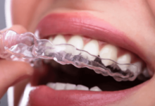 Clear Orthodontic Braces: The Invisible Solution to Straightening Teeth