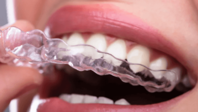 Clear Orthodontic Braces: The Invisible Solution to Straightening Teeth