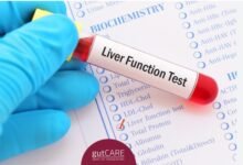 Liver Function Test