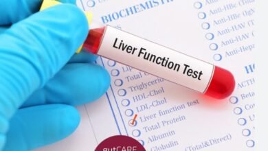 Liver Function Test