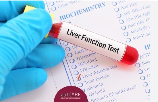 Liver Function Test